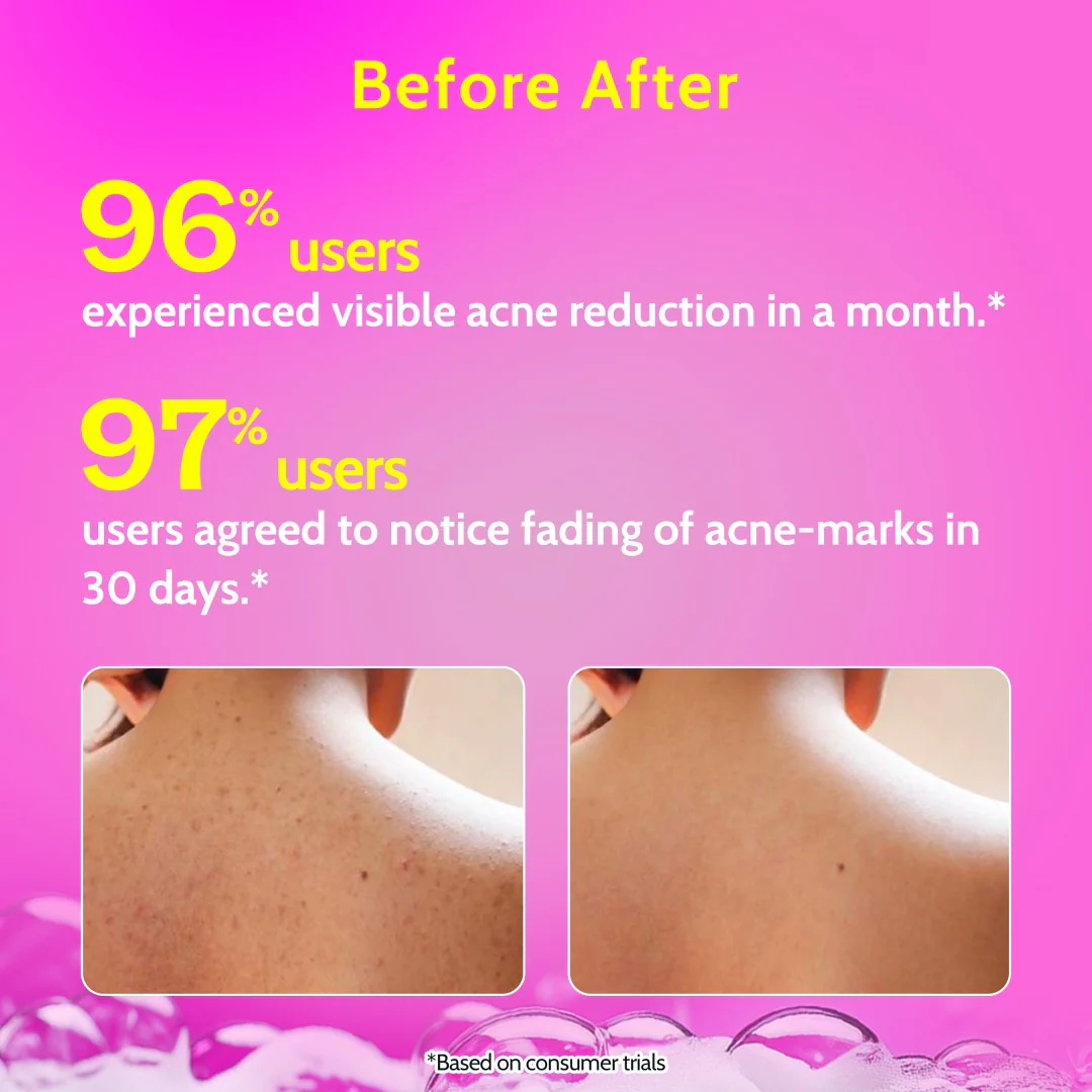 1% Salicylic Acid Body Wash for Acne Control - 473 ml - Image 6