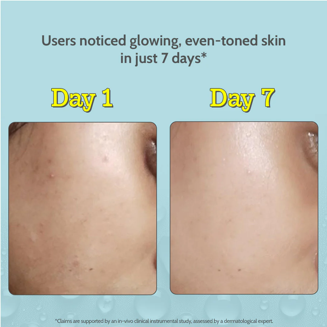 10% Vitamin C Serum for Glowing & Bright Skin - 10 ml - Image 8