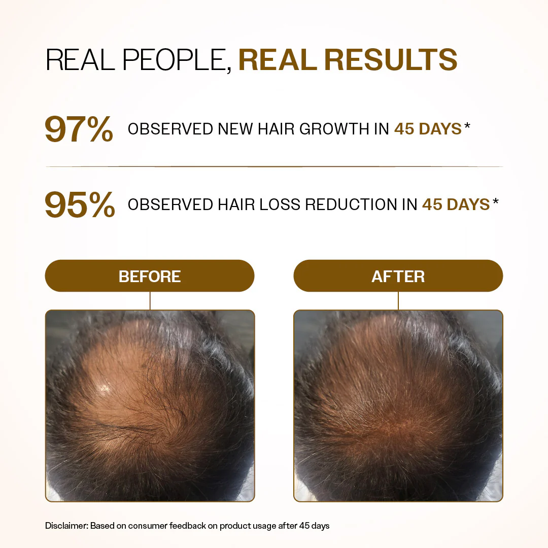 Advanced Hair Growth Serum Roll-On with Redensyl, Rosemary & Rice Water- 25 ml | Pack of 2 - Image 4