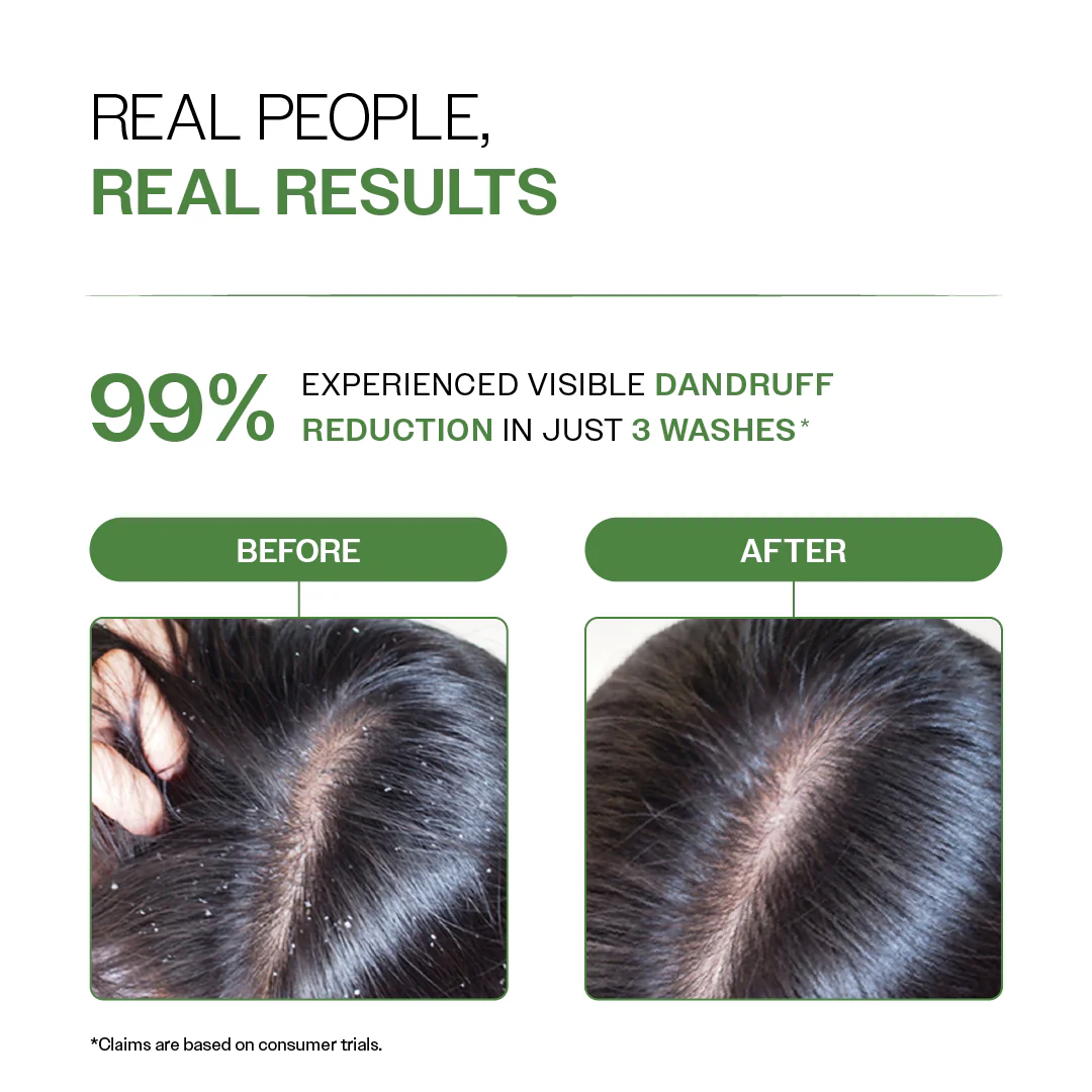 Anti Dandruff Shampoo with Salicylic Acid & Biotin - Image 5
