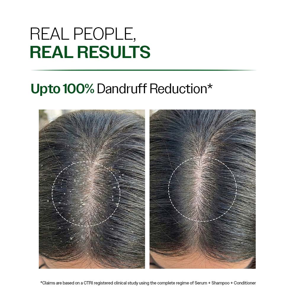 Anti Dandruff Shampoo with Salicylic Acid & Biotin - 750 ml | Pack of 2 - Image 3