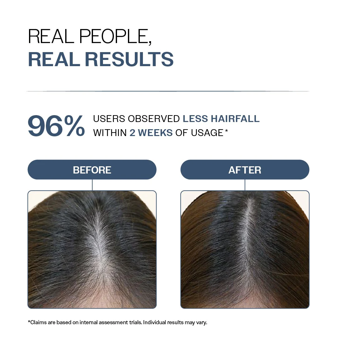 Anti-Hair Fall Shampoo with Adenosine & Peptides - 250 ml | Pack of 2 - Image 5