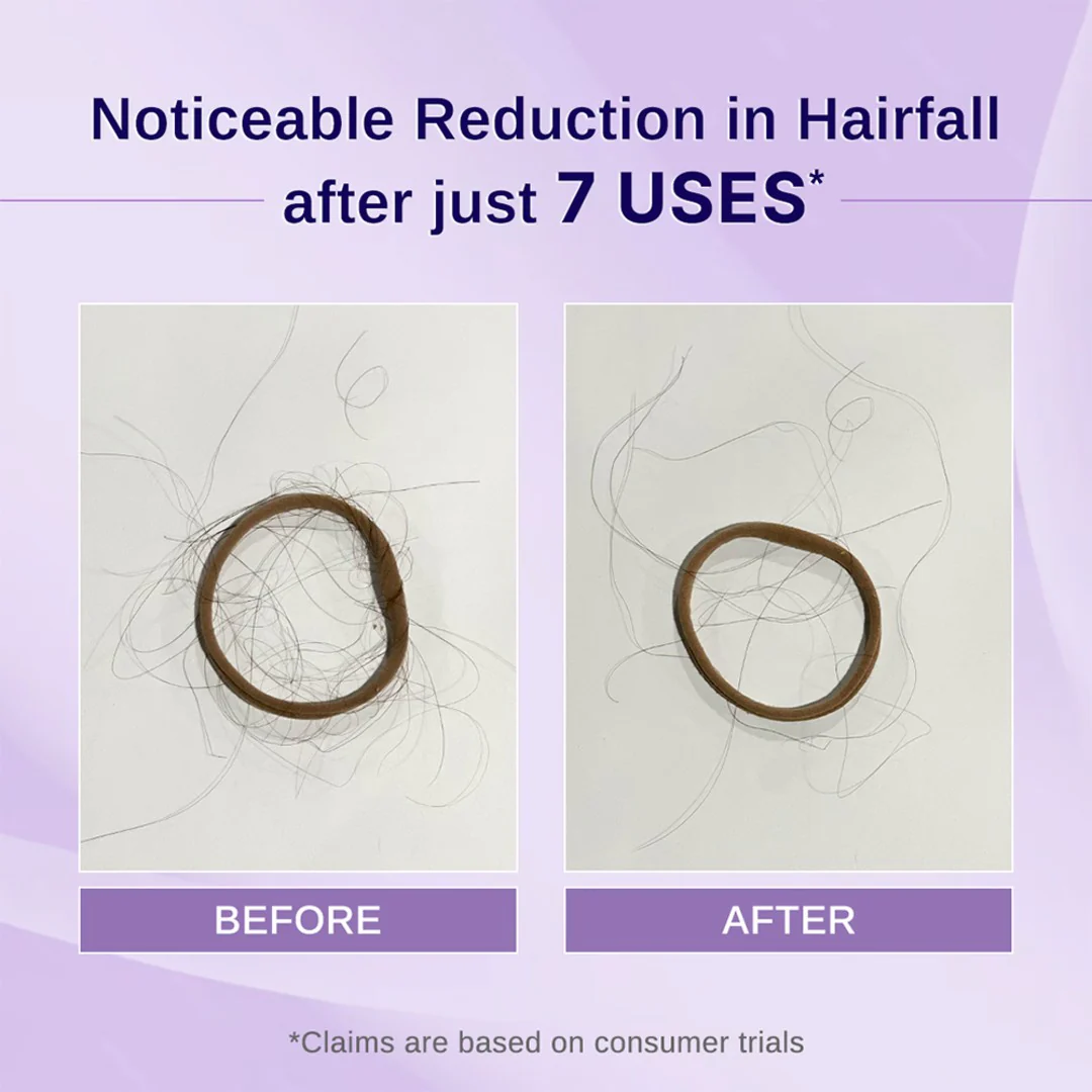 Rosemary & Hibiscus Hair Growth Oil - 100 ml - Image 3